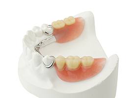 Smile model and partial dentures