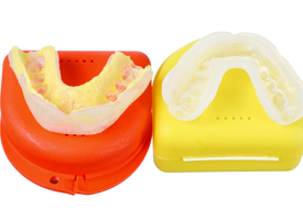 Custom crafted nightguards for bruxism