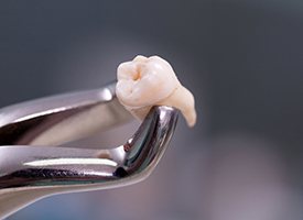 Metal forceps holding an extracted tooth