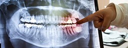 Panoramic dental x-rays on computer