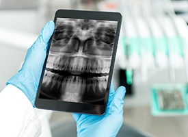 Dental x-rays displayed on tablet