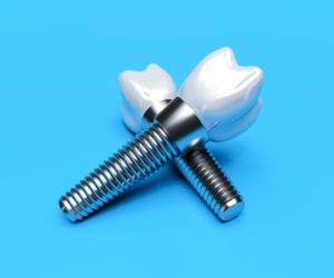 dental implants